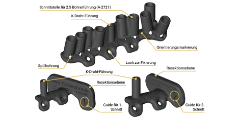 CMX Patient-Specific - Mandible Reconstruction