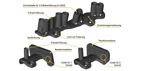 CMX Patient-Specific - Mandible Reconstruction